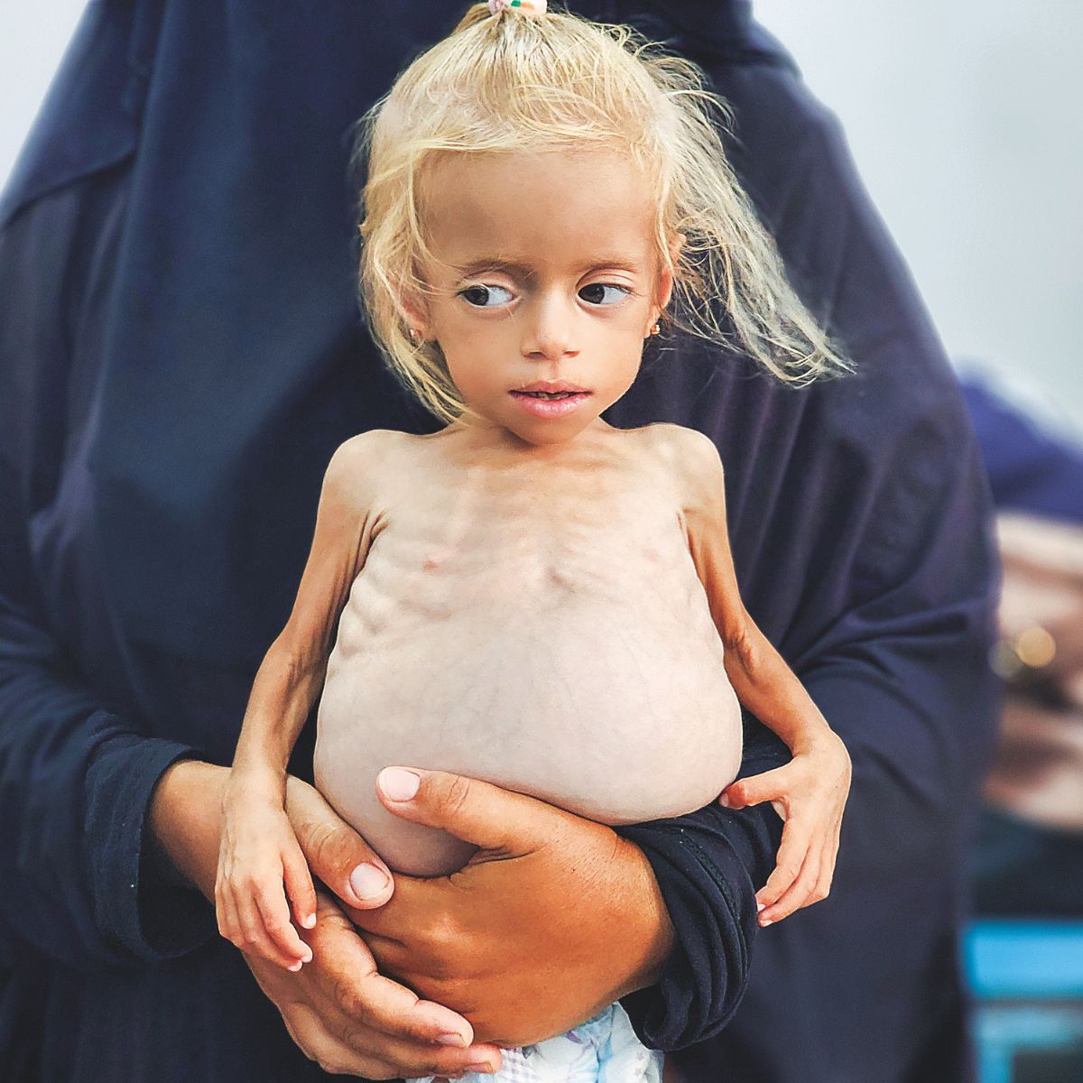 El último refugio de los niños de Gaza: el único hospital que sigue en pie